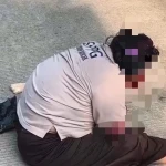 Diduga Kecelakaan di Gunungsari, Perempuan Berseragam SPPG Mancak Terluka Parah di Wajah