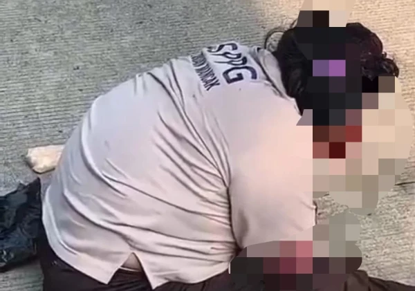 Diduga Kecelakaan di Gunungsari, Perempuan Berseragam SPPG Mancak Terluka Parah di Wajah