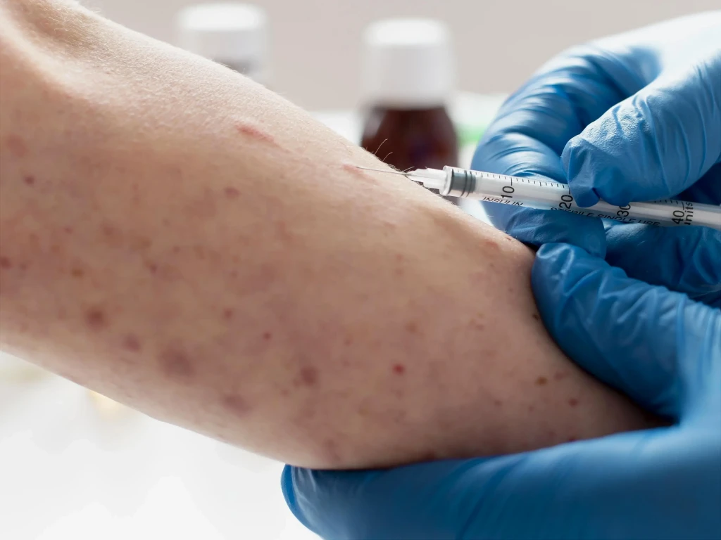 Kemenkes Ingatkan Waspada Campak Jelang Mudik Lebaran, Imunisasi Anak Jadi Kunci