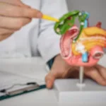 Metode Baru dalam Penanganan Batu Empedu: ERCP, Solusi Minim Invasif dengan Akurasi Tinggi