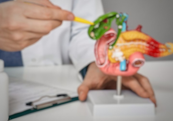 Metode Baru dalam Penanganan Batu Empedu: ERCP, Solusi Minim Invasif dengan Akurasi Tinggi