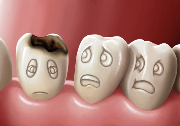 Biasakan Minum Air Putih, Cara Sederhana Kurangi Risiko Obesitas dan Gigi Berlubang