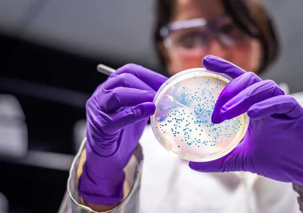 Rasanya Juara, Tapi Amankah? Pentingnya Analisis Mikrobiologi untuk Keamanan Pangan