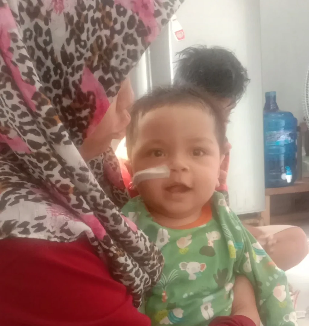 Kirimkan Bantuan Pengobatan untuk Abizar yang Mengidap Hidrosefalus.