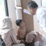 Pemkot Tangerang Intensifkan Upaya Penurunan Stunting melalui Skrining Balita