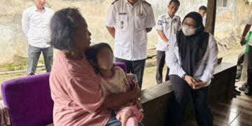 Wabup Tangerang Kunjungi Anak Penderita Cerebral Palsy, Pastikan Dapatkan Pelayanan Medis Gratis